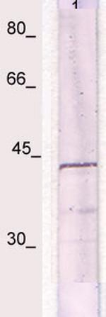 IkBa (NFKB1A) Antibody in Western Blot (WB)