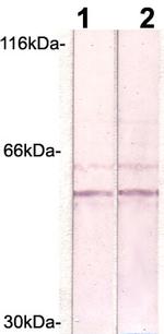 LSP Antibody in Western Blot (WB)