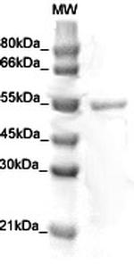 Phospho-Desmin (Thr76, Thr77) Antibody in Western Blot (WB)