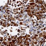 Desmin Antibody in Immunohistochemistry (Paraffin) (IHC (P))