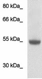 Desmin Antibody in Western Blot (WB)