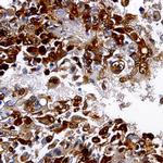 Desmin Antibody in Immunohistochemistry (Paraffin) (IHC (P))