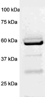 p56-LCK (LSK) Antibody in Western Blot (WB)