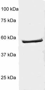 p56-LCK (LSK) Antibody in Western Blot (WB)