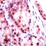 NKX3.1 Antibody in Immunohistochemistry (PFA fixed) (IHC (PFA))