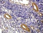 FOXP3 Antibody in Immunohistochemistry (Paraffin) (IHC (P))