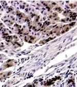 FOXP4 Antibody in Immunohistochemistry (Paraffin) (IHC (P))
