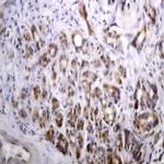 IRS-1 Antibody in Immunohistochemistry (Paraffin) (IHC (P))