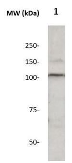 Corin Antibody in Western Blot (WB)