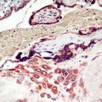 MMP-7 (Matrilysin) Antibody in Immunohistochemistry (Paraffin) (IHC (P))