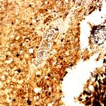 MMP-13 Antibody in Immunohistochemistry (Paraffin) (IHC (P))