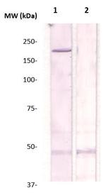 Phospho-Rho Kinase/ROCKII (Thr249) Antibody in Western Blot (WB)