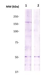 Rho Kinase/ROCKII Antibody in Western Blot (WB)