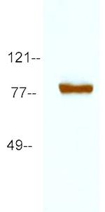 Shaker Antibody in Western Blot (WB)