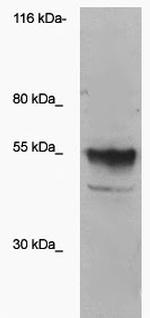 Sialyltransferase Antibody in Western Blot (WB)