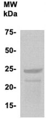Phospho-PLAC1 (Ser121, Tyr147, Ser156) Antibody in Western Blot (WB)