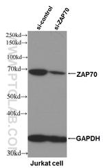 ZAP70 Antibody in Western Blot (WB)