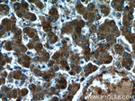 TRIP6 Antibody in Immunohistochemistry (Paraffin) (IHC (P))