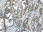 TRIP6 Antibody in Immunohistochemistry (Paraffin) (IHC (P))