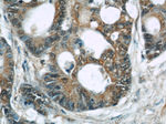 TRIP6 Antibody in Immunohistochemistry (Paraffin) (IHC (P))
