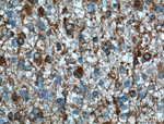 TRIP6 Antibody in Immunohistochemistry (Paraffin) (IHC (P))