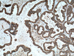 TRIP6 Antibody in Immunohistochemistry (Paraffin) (IHC (P))