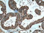 TRIP6 Antibody in Immunohistochemistry (Paraffin) (IHC (P))