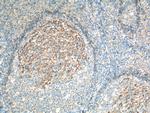 CD23 Antibody in Immunohistochemistry (Paraffin) (IHC (P))