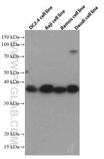CD23 Antibody in Western Blot (WB)