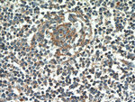 CD23 Antibody in Immunohistochemistry (Paraffin) (IHC (P))
