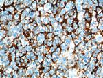 CD23 Antibody in Immunohistochemistry (Paraffin) (IHC (P))
