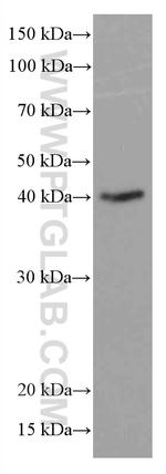CD23 Antibody in Western Blot (WB)