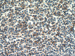 CD23 Antibody in Immunohistochemistry (Paraffin) (IHC (P))