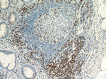 CD7 Antibody in Immunohistochemistry (Paraffin) (IHC (P))