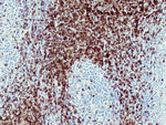 CD7 Antibody in Immunohistochemistry (Paraffin) (IHC (P))