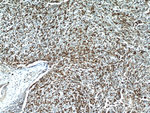 CD7 Antibody in Immunohistochemistry (Paraffin) (IHC (P))