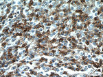 CD7 Antibody in Immunohistochemistry (Paraffin) (IHC (P))