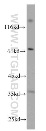 CD7 Antibody in Western Blot (WB)
