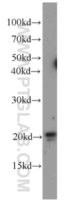 P21 Antibody in Western Blot (WB)