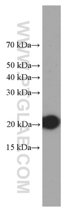 P21 Antibody in Western Blot (WB)
