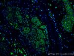 CXCR7 Antibody in Immunohistochemistry (PFA fixed) (IHC (PFA))
