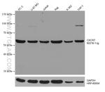 CXCR7 Antibody in Western Blot (WB)