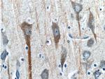 CHRNA7 Antibody in Immunohistochemistry (Paraffin) (IHC (P))