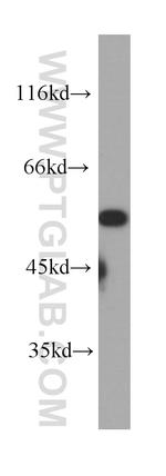 CHRNA7 Antibody in Western Blot (WB)
