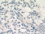 SMMHC Antibody in Immunohistochemistry (Paraffin) (IHC (P))