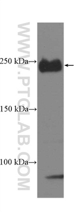SMMHC Antibody in Western Blot (WB)