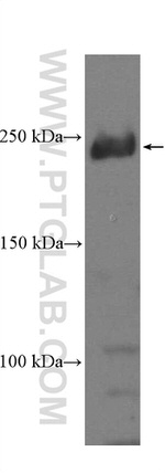SMMHC Antibody in Western Blot (WB)