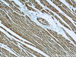 Desmin Antibody in Immunohistochemistry (Paraffin) (IHC (P))