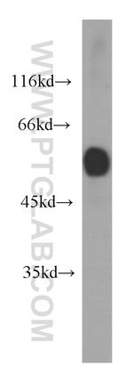 Desmin Antibody in Western Blot (WB)