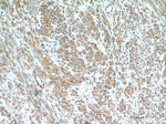 Desmin Antibody in Immunohistochemistry (Paraffin) (IHC (P))